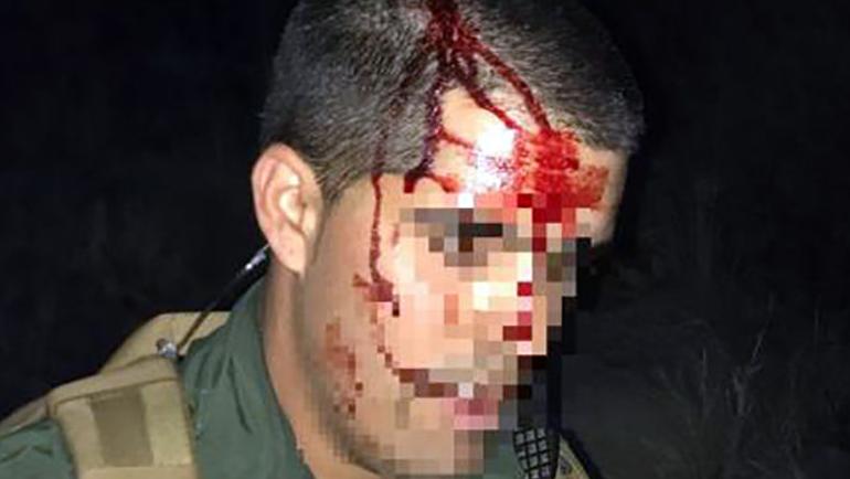Tucson Sector Border Patrol: Immigrant smashed agent’s head into rock
